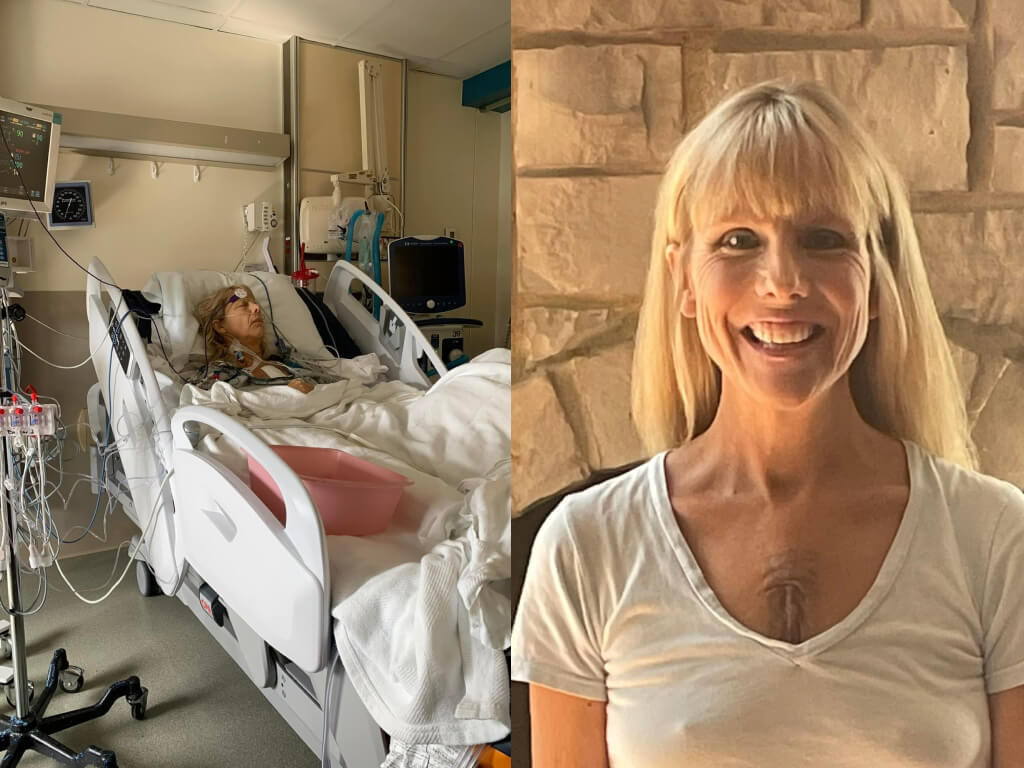 Before and after of Regan in hospital and recovery